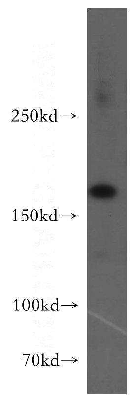 HEK-293 cells were subjected to SDS PAGE followed by western blot with Catalog No:116555(UGCGL2 antibody) at dilution of 1:300