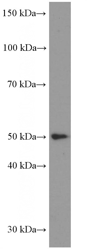SW 1990 cells were subjected to SDS PAGE followed by western blot with Catalog No:107405(LIPH Antibody) at dilution of 1:2000