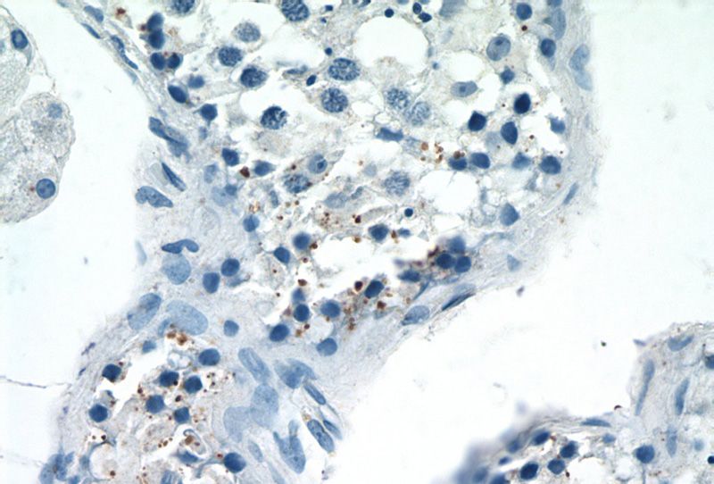 Immunohistochemistry of paraffin-embedded human testis tissue slide using Catalog No:112156(LATS1 Antibody) at dilution of 1:50 (under 40x lens)