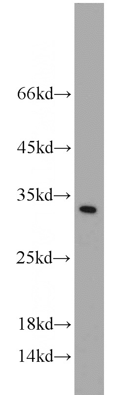 mouse brain tissue were subjected to SDS PAGE followed by western blot with Catalog No:115765(SYNGR1 antibody) at dilution of 1:100