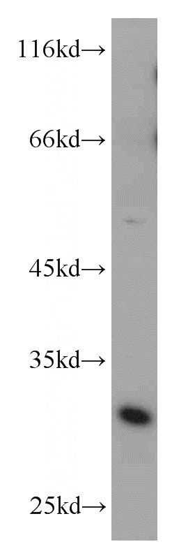 mouse testis tissue were subjected to SDS PAGE followed by western blot with Catalog No:117067(ZMAT3 antibody) at dilution of 1:800