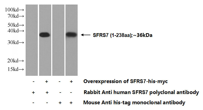 Transfected HEK-293 cells were subjected to SDS PAGE followed by western blot with Catalog No:115152(SFRS7 Antibody) at dilution of 1:1000