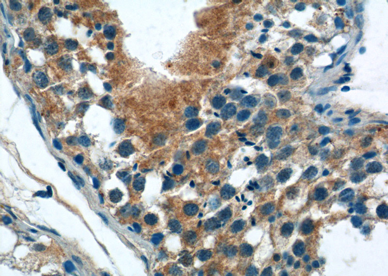 Immunohistochemistry of paraffin-embedded human testis tissue slide using Catalog No:111618(IFIT1L Antibody) at dilution of 1:50 (under 40x lens)