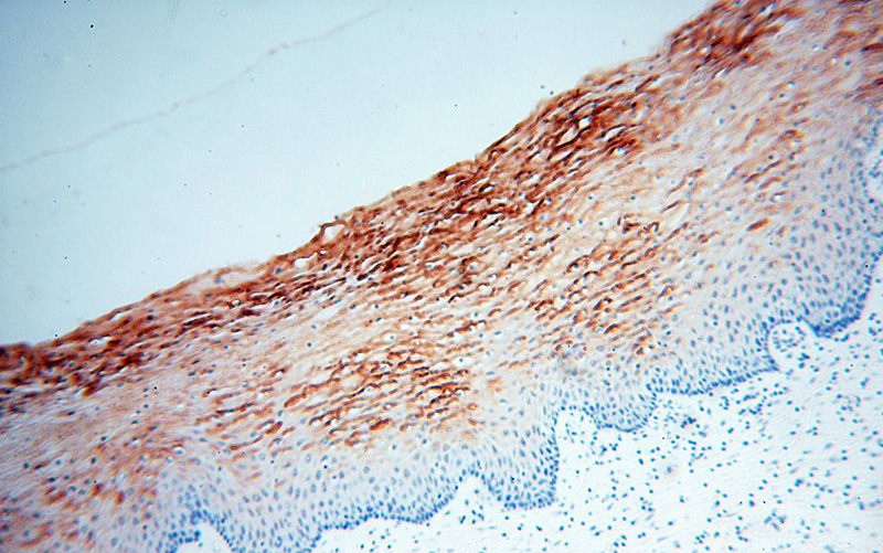 Immunohistochemical of paraffin-embedded human cervix using Catalog No:109806(KRT4 antibody) at dilution of 1:100 (under 10x lens)