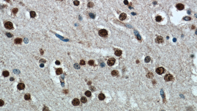 Immunohistochemical of paraffin-embedded human brain using Catalog No:115881(TBR1 antibody) at dilution of 1:100 (under 40x lens)