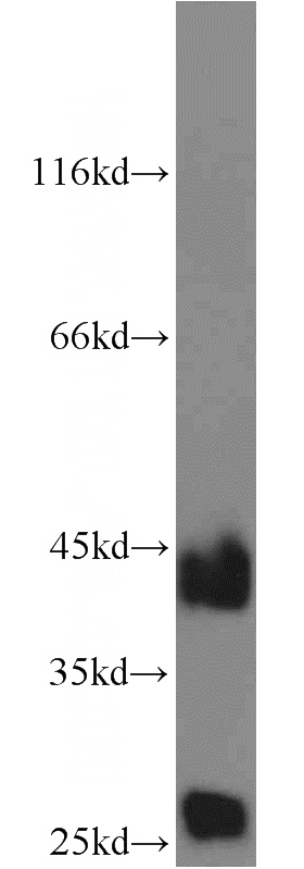 A375 cells were subjected to SDS PAGE followed by western blot with Catalog No:108887(CTSB antibody) at dilution of 1:800