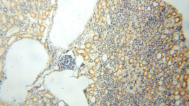 Immunohistochemical of paraffin-embedded human kidney using Catalog No:110846(GALNT14 antibody) at dilution of 1:200 (under 10x lens)