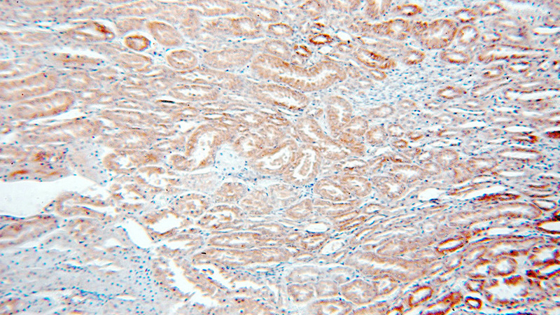 Immunohistochemical of paraffin-embedded human kidney using Catalog No:109756(TRAILR4 antibody) at dilution of 1:50 (under 10x lens)