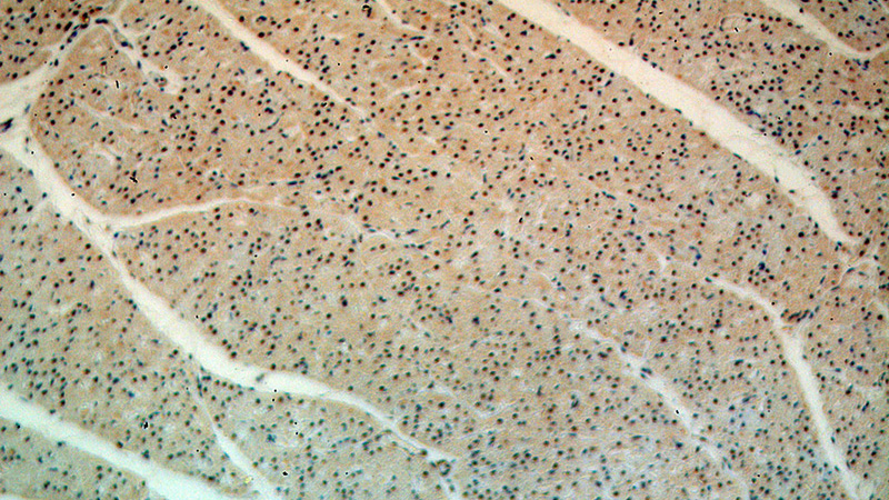 Immunohistochemical of paraffin-embedded human heart using Catalog No:116471(UBAC1 antibody) at dilution of 1:100 (under 10x lens)