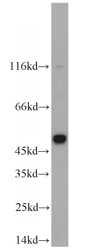SH-SY5Y cells were subjected to SDS PAGE followed by western blot with Catalog No:109286(CHRNB4 antibody) at dilution of 1:2000