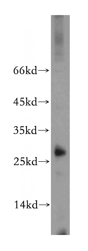 HEK-293 cells were subjected to SDS PAGE followed by western blot with Catalog No:115679(STARD3NL antibody) at dilution of 1:1000