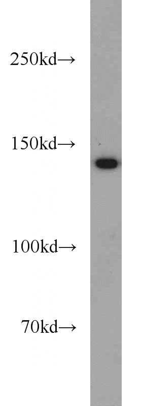 mouse skeletal muscle tissue were subjected to SDS PAGE followed by western blot with Catalog No:112913(MYBPC1 antibody) at dilution of 1:800