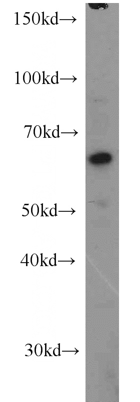 SKOV-3 cells were subjected to SDS PAGE followed by western blot with Catalog No:113255(NMT1 antibody) at dilution of 1:1000