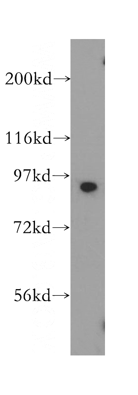 Jurkat cells were subjected to SDS PAGE followed by western blot with Catalog No:115518(SOX6 antibody) at dilution of 1:500