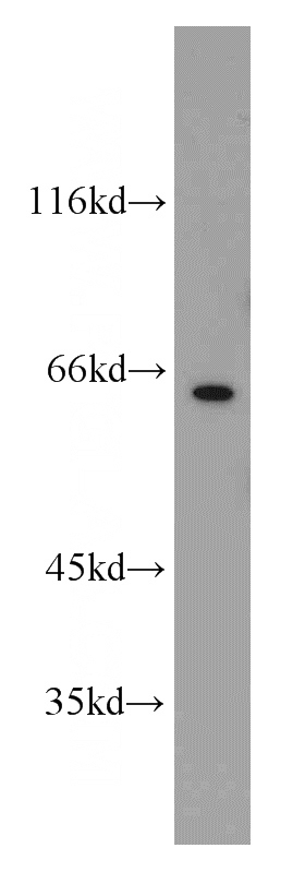 A431 cells were subjected to SDS PAGE followed by western blot with Catalog No:111158(PCDGF,GRN antibody) at dilution of 1:500