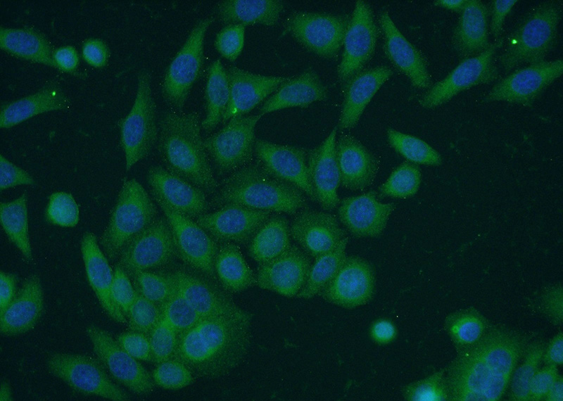 Immunofluorescent analysis of HeLa cells using Catalog No:115864(TBC1D22A Antibody) at dilution of 1:50 and Alexa Fluor 488-congugated AffiniPure Goat Anti-Rabbit IgG(H+L)