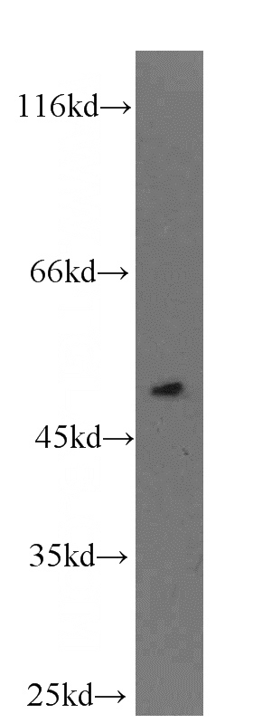 C6 cells were subjected to SDS PAGE followed by western blot with Catalog No:109646(CXCR7 antibody) at dilution of 1:200