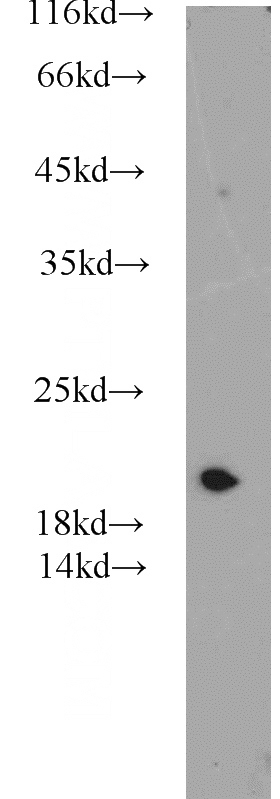 HeLa cells were subjected to SDS PAGE followed by western blot with Catalog No:108195(ARL1 antibody) at dilution of 1:500