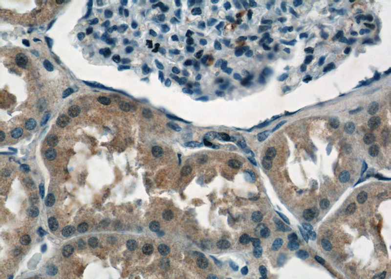Immunohistochemistry of paraffin-embedded human kidney tissue slide using Catalog No:113218(NPLoc4 Antibody) at dilution of 1:50 (under 40x lens)