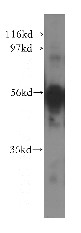 BxPC-3 cells were subjected to SDS PAGE followed by western blot with Catalog No:109635(CXADR antibody) at dilution of 1:500