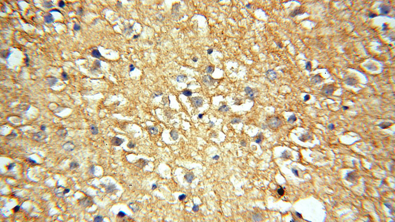 Immunohistochemical of paraffin-embedded human brain using Catalog No:114861(RTN1 antibody) at dilution of 1:100 (under 40x lens)