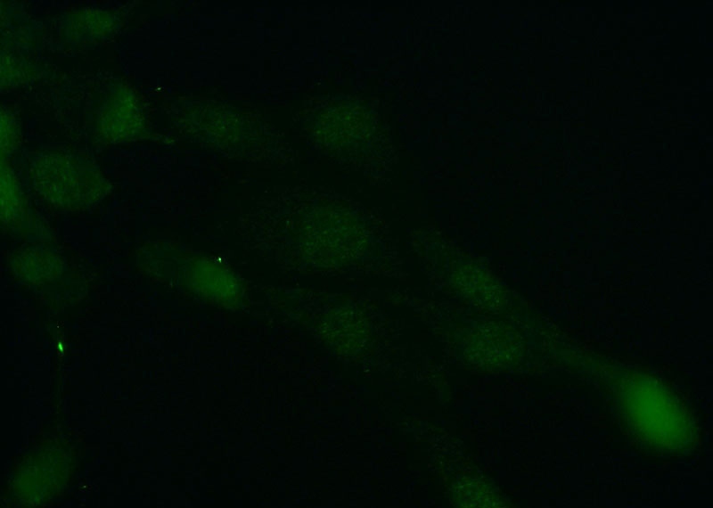 Immunofluorescent analysis of (10% Formaldehyde) fixed A431 cells using Catalog No:108868(CSNK2B-Specific Antibody) at dilution of 1:50 and Alexa Fluor 488-congugated AffiniPure Goat Anti-Rabbit IgG(H+L)