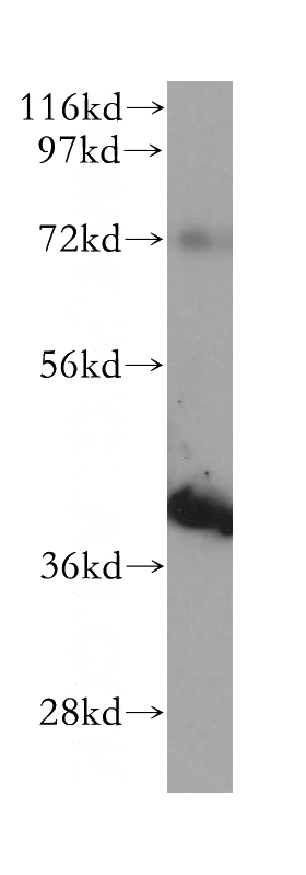 Raji cells were subjected to SDS PAGE followed by western blot with Catalog No:115264(SHARPIN antibody) at dilution of 1:500