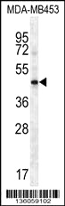 human brain tissue were subjected to SDS PAGE followed by western blot with Catalog No:107149(CDX2 antibody) at dilution of 1:1000