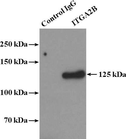 IP Result of anti-CD41/Integrin alpha 2b (IP:Catalog No:109121, 4ug; Detection:Catalog No:109121 1:2000) with human plasma tissue lysate 4000ug.