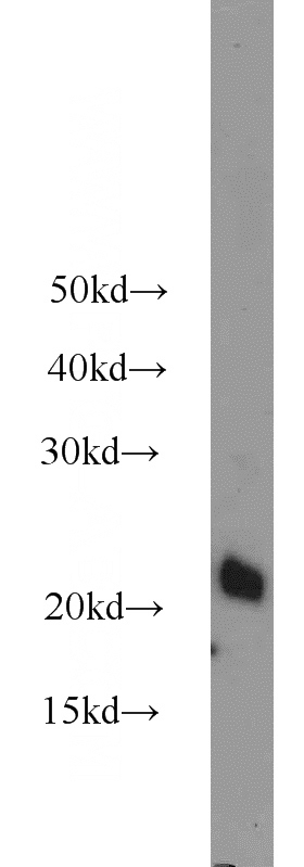 NIH/3T3 cells were subjected to SDS PAGE followed by western blot with Catalog No:108223(ASF1A antibody) at dilution of 1:1000