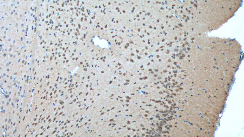 Immunohistochemistry of paraffin-embedded mouse brain tissue slide using Catalog No:114344(PVRL1 Antibody) at dilution of 1:200 (under 10x lens). heat mediated antigen retrieved with Tris-EDTA buffer(pH9).