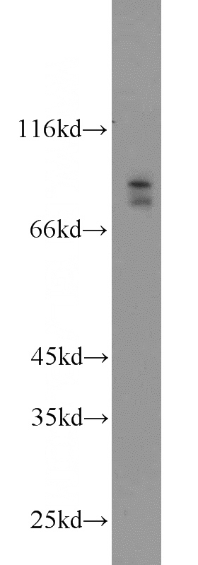 mouse brain tissue were subjected to SDS PAGE followed by western blot with Catalog No:117245(BRSK2 antibody) at dilution of 1:500