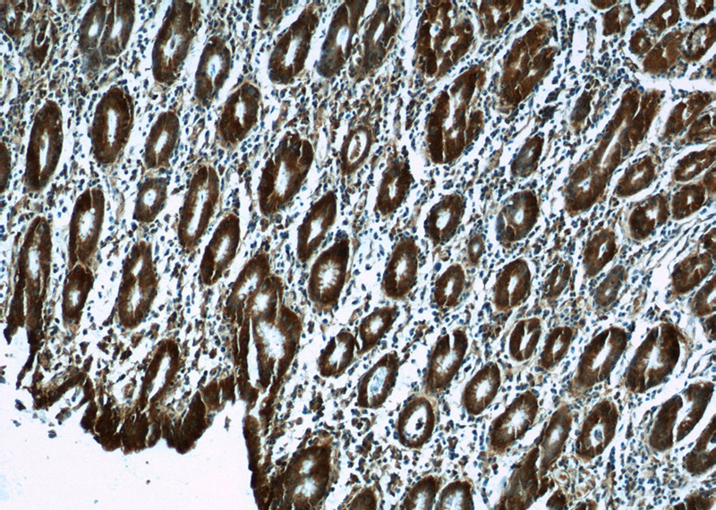 Immunohistochemistry of paraffin-embedded human stomach tissue slide using Catalog No:108936(CAPNS1 Antibody) at dilution of 1:50 (under 10x lens)