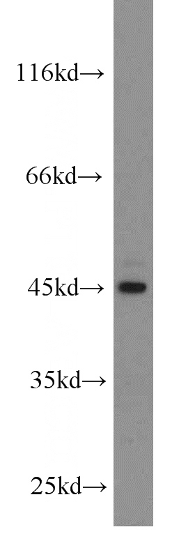 HEK-293 cells were subjected to SDS PAGE followed by western blot with Catalog No:107722(ACADSB antibody) at dilution of 1:300