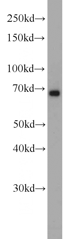 HepG2 cells were subjected to SDS PAGE followed by western blot with Catalog No:111084(GK antibody) at dilution of 1:1000