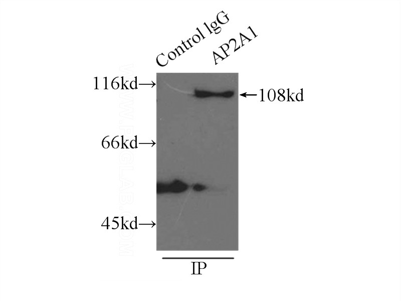 IP Result of anti-AP2A1 (IP:Catalog No:107866, 3ug; Detection:Catalog No:107866 1:1000) with mouse skeletal muscle tissue lysate 3500ug.