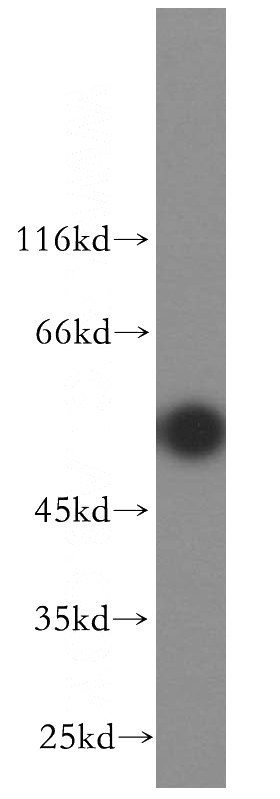 HepG2 cells were subjected to SDS PAGE followed by western blot with Catalog No:110336(ENTPD8 antibody) at dilution of 1:500