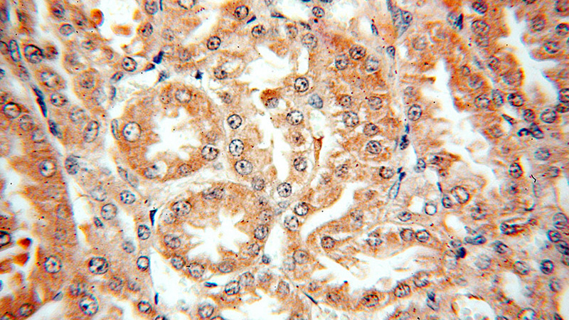 Immunohistochemical of paraffin-embedded human kidney using Catalog No:109689(CYP27A1 antibody) at dilution of 1:100 (under 40x lens)