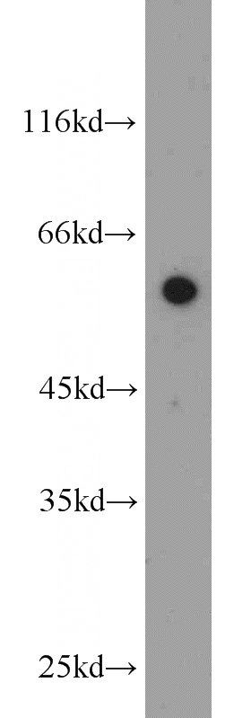 HeLa cells were subjected to SDS PAGE followed by western blot with Catalog No:116862(WDR32 antibody) at dilution of 1:800