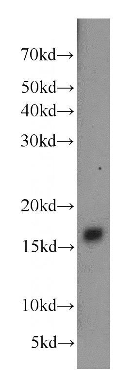 human brain tissue were subjected to SDS PAGE followed by western blot with Catalog No:109511(CPLX2 antibody) at dilution of 1:1000