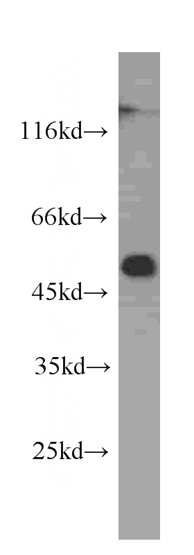 MCF7 cells were subjected to SDS PAGE followed by western blot with Catalog No:107570(ALDH1A1 antibody) at dilution of 1:500