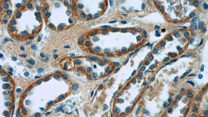 Immunohistochemistry of paraffin-embedded human kidney tissue slide using Catalog No:115613(SSTR2 Antibody) at dilution of 1:50 (under 40x lens)