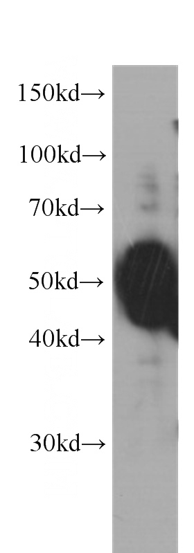 human brain tissue were subjected to SDS PAGE followed by western blot with Catalog No:107344(ocT4 antibody) at dilution of 1:1000