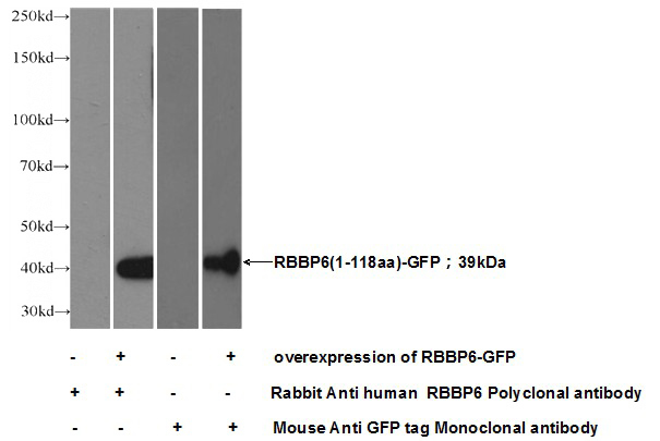 Transfected HEK-293 cells were subjected to SDS PAGE followed by western blot with Catalog No:114592(RBBP6 Antibody) at dilution of 1:500