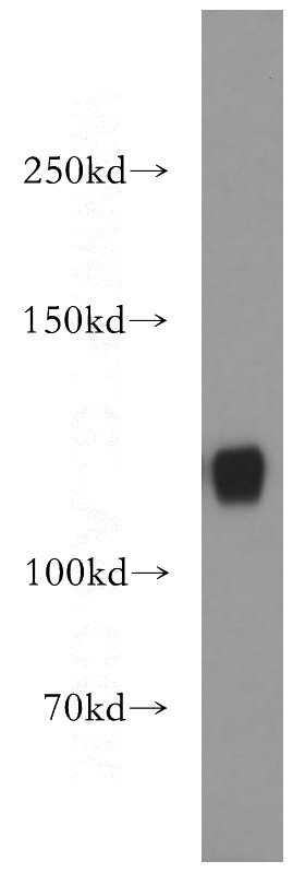 Jurkat cells were subjected to SDS PAGE followed by western blot with Catalog No:112609(MICAL1 antibody) at dilution of 1:1000