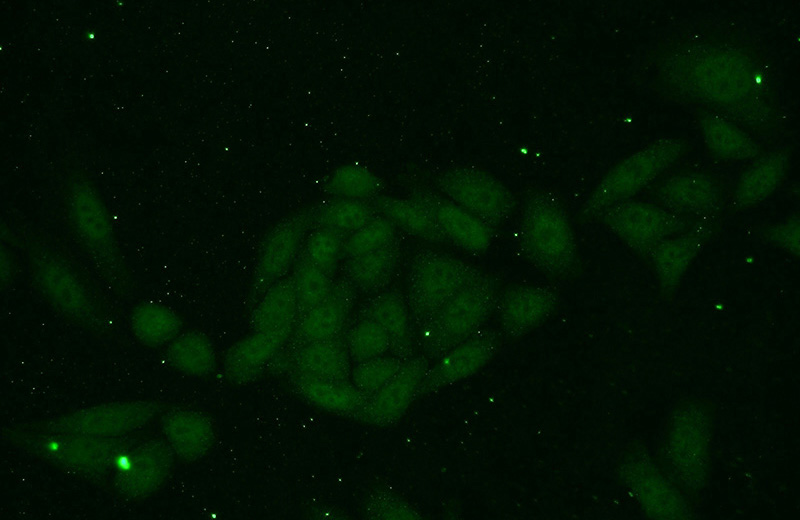 Immunofluorescent analysis of HepG2 cells using Catalog No:115977(TAF11 Antibody) at dilution of 1:50 and Alexa Fluor 488-congugated AffiniPure Goat Anti-Rabbit IgG(H+L)