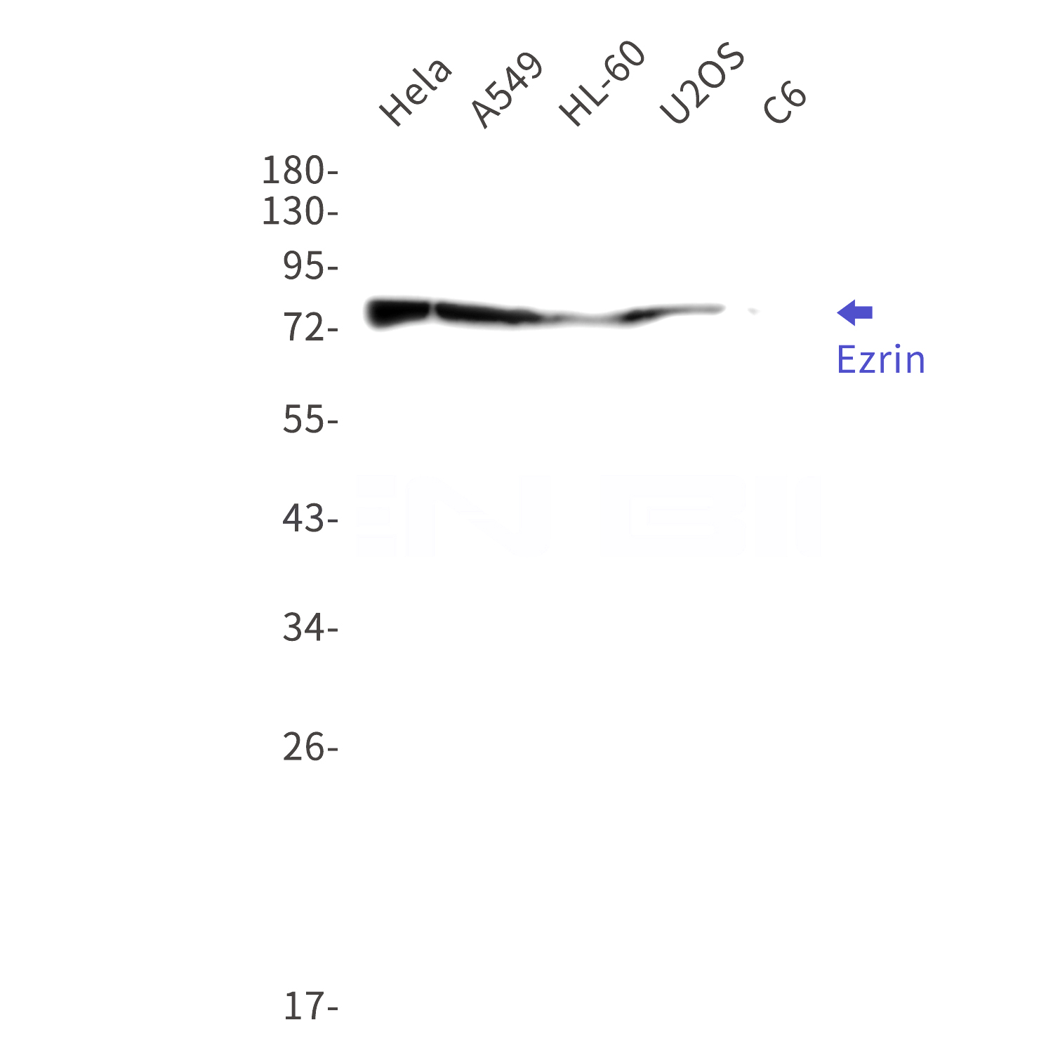 Western blot detection of Ezrin in Hela,A549,HL-60,U2OS,C6 cell lysates using Ezrin Rabbit mAb(1:1000 diluted).Predicted band size:69kDa.Observed band size:80kDa.