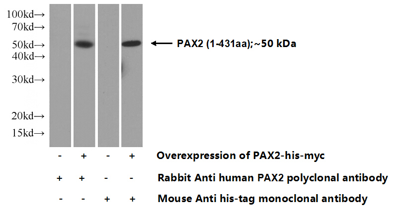 Transfected HEK-293 cells were subjected to SDS PAGE followed by western blot with Catalog No:113604(PAX2 Antibody) at dilution of 1:1000