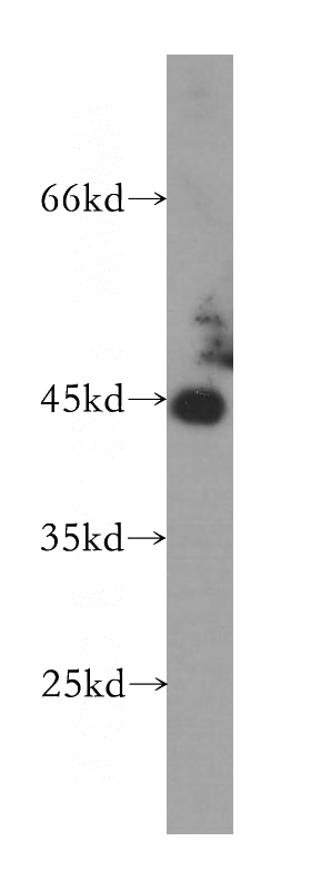 Jurkat cells were subjected to SDS PAGE followed by western blot with Catalog No:111415(HLA class I (HLA-B) antibody) at dilution of 1:800