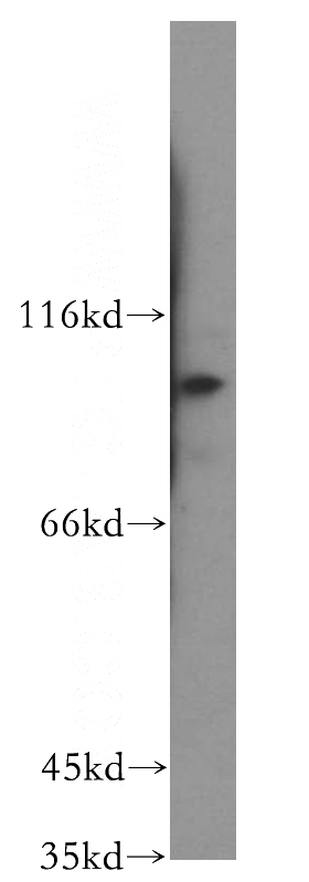 Jurkat cells were subjected to SDS PAGE followed by western blot with Catalog No:112002(KIF18A antibody) at dilution of 1:500